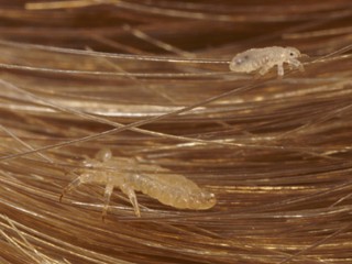 What Head Lice Look Like