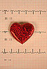 Heart Disease Is the Leading Cause of Death Amongst Women
