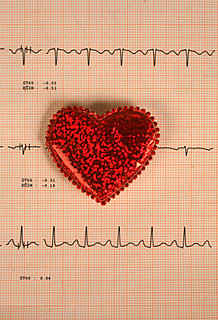 Heart Disease Is the Leading Cause of Death Amongst Women