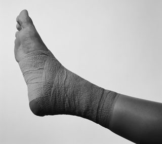 Remember R.I.C.E. For Injuries to Joints and Muscles