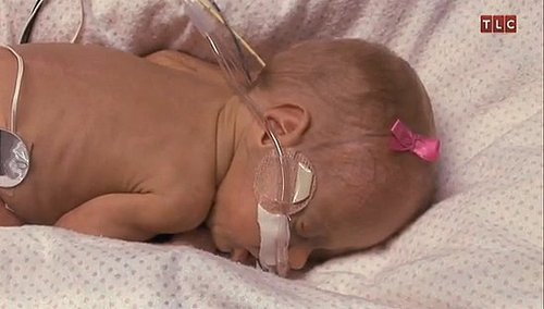 Photos of Michelle and Jim Bob Duggar's Baby Josie