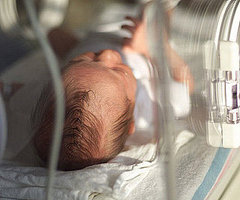 How to Decide Whether to Circumcise How to Decide Whether to Circumcise