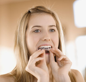 Teeth Whitening Most Popular Cosmetic Treatment
