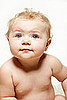 Rise in Shaken Baby Syndrome