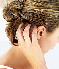 How to Get Rid of Scalp Acne