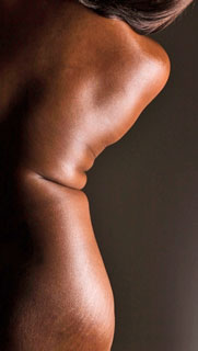 Stretch Mark Advice