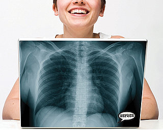 X-Ray Laptop Skin