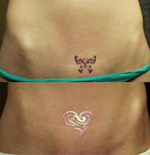 New Bikini Wax Tattoo
