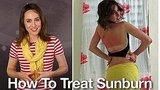 How to Treat Sunburn: Remedies and Tips on Treating Sunburn