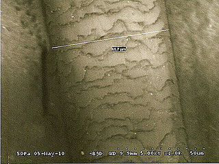 Hair Under a Microscope