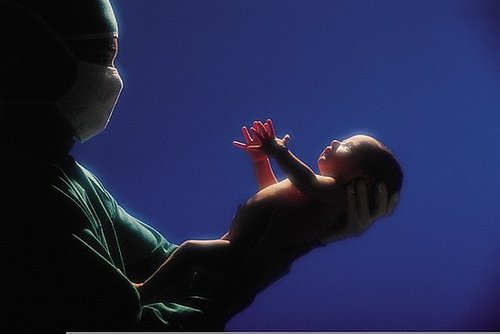 When Pregnancy Ends in Induction