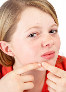 New Research Suggests Acne, Not Accutane, Causes Depression in Teens