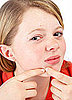 New Research Suggests Acne, Not Accutane, Causes Depression in Teens