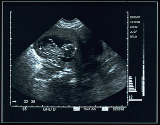 BirthorNot.com Is Fake