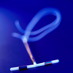 IUDs May Lower Risk of Cervical Cancer