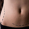 Freezing Fat For Future Use