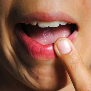 Why You Shouldn't Use Vaseline on Your Lips and Skin