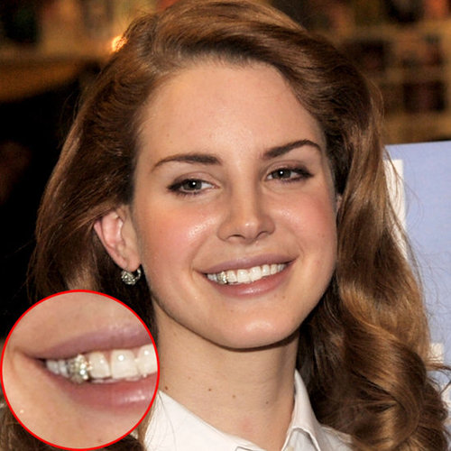 Lana Del Rey Unveils Glitter Tooth