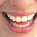 Gums