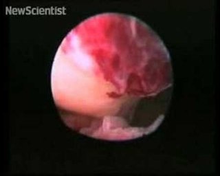 Ever Wonder What Ovulation Looks Like? 