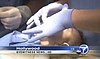 Baby Girl Born with Two Mouths Receives Life-Saving Surgery (VIDEO)