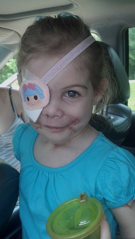 Did This Girl's Scars Get Her Kicked Out of KFC? Did This Girl's Scars Get Her Kicked Out of KFC?