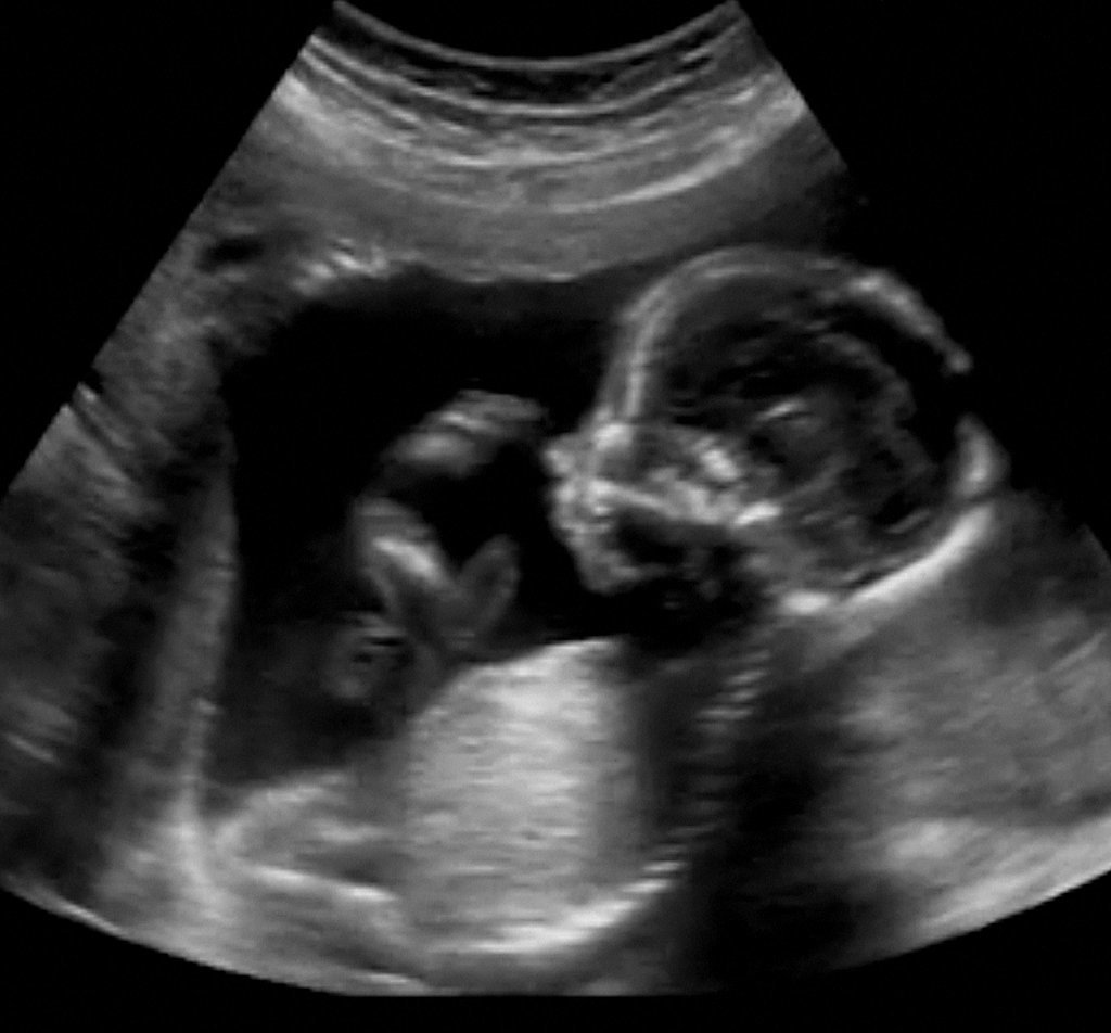 Some Fetus Cells Are Absorbed by the Mother — a Part of You Will Always Be With Your Mom Some Fetus Cells Are Absorbed by the Mother — a Part of You Will Always Be With Your Mom