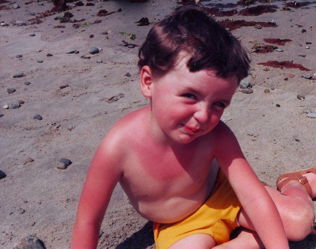 What To Do If Baby Sunburn