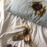 Phone Burns Under Pillow Phone Burns Under Pillow