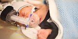 Premature Baby's Incredible Transformation Is Proof That Miracles Do Happen Premature Baby's Incredible Transformation Is Proof That Miracles Do Happen