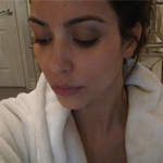 Kim's Black Eye, Rob & Kristen in Bed, & NPH Ditching Acting? Kim's Black Eye, Rob & Kristen in Bed, & NPH Ditching Acting?
