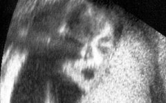 Man in the Mirror or Plain Old Ultrasound? Man in the Mirror or Plain Old Ultrasound?