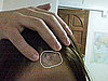 Healing Help For Chemical Burns
