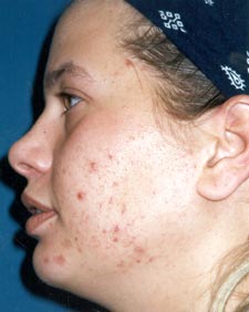Bumpy Skin Suggestions
