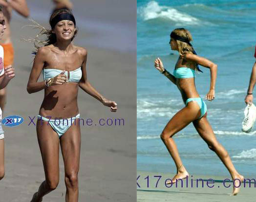 Nicole - Still Sickly Skinny