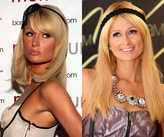 Which extensions should Paris choose? Which extensions should Paris choose?