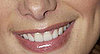 Can You Guess Which Celebrities' Dimples These Are?