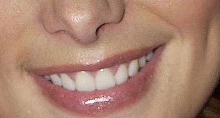 Can You Guess Which Celebrities' Dimples These Are?