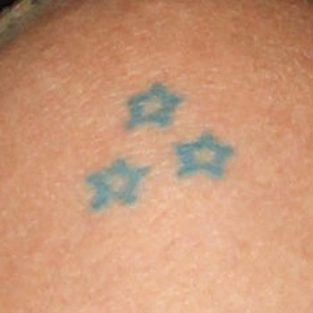 Image Image