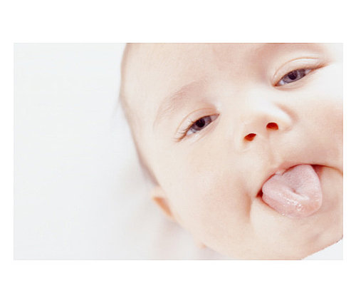 Torticollis Torticollis