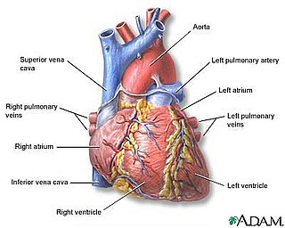 Michael Jackson and the Difference Between Sudden Cardiac Arrest and Heart Attack
