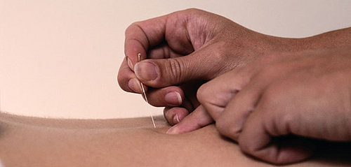Acupuncture Your Way to Pregnancy