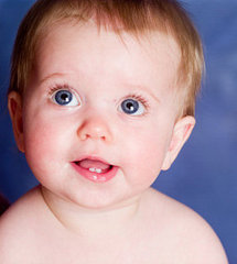 High Grade Fevers and Teething