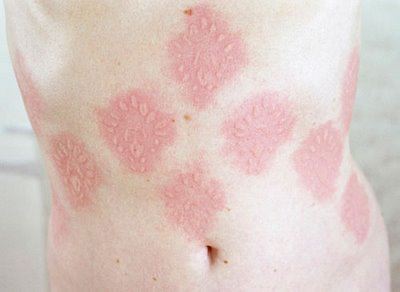 skin1 skin1