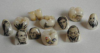 Would You Tattoo Your Teeth?