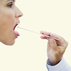 Gonorrhea of the Throat?