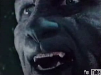 Flashback: Manimal 