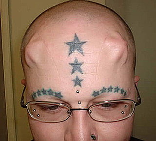 Extreme Body Modifier Has Implants in His Head