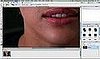 How To Get Rid of Zits With Photoshop