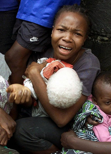 Pale and Persecuted: Albinos Hunted, Terrorized in Tanzania